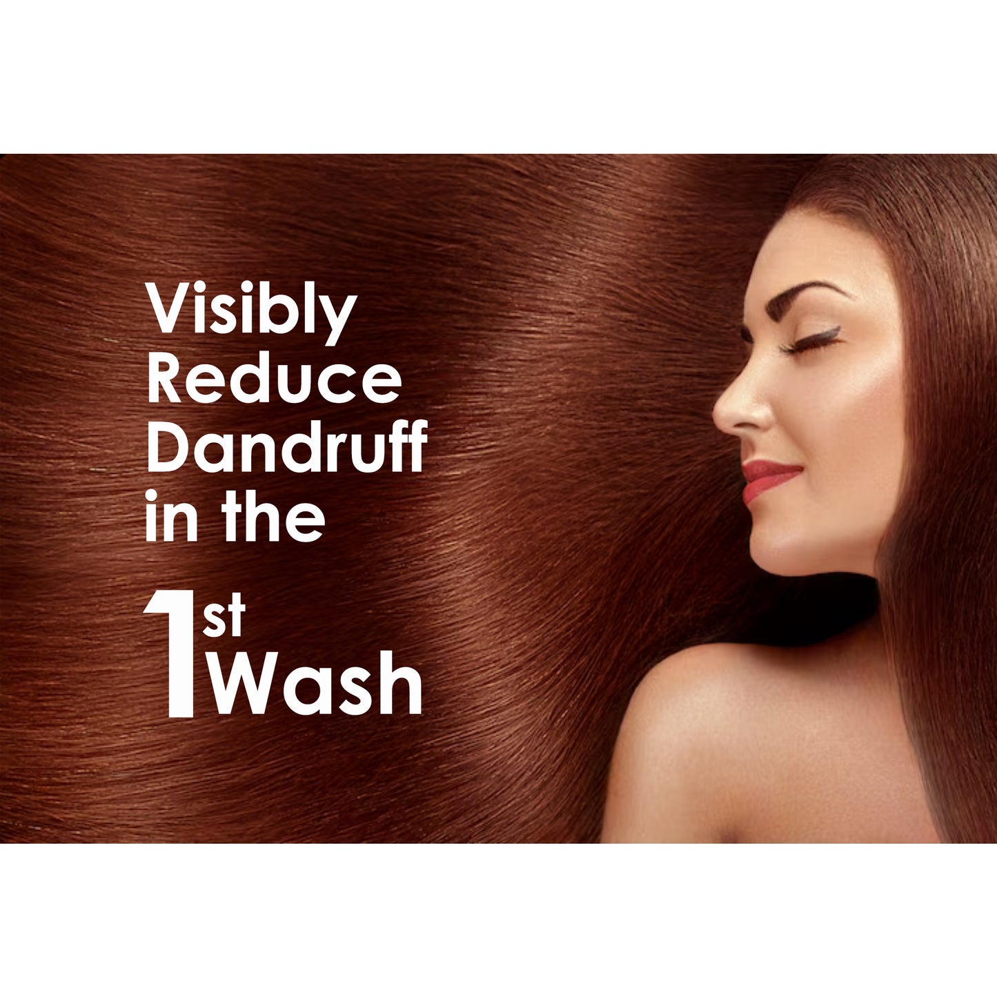Pink Root Dandruff Control Shampoo 250 ml - For Controlling Dandruff, Hair Growth