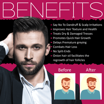 Mister Beard Onion Hair Oil, For Hair Growth, Anti-hair Fall, Healthy Scalp, Conditioning, Removing Lice, Prevents Greying, 100ml - Pink Root